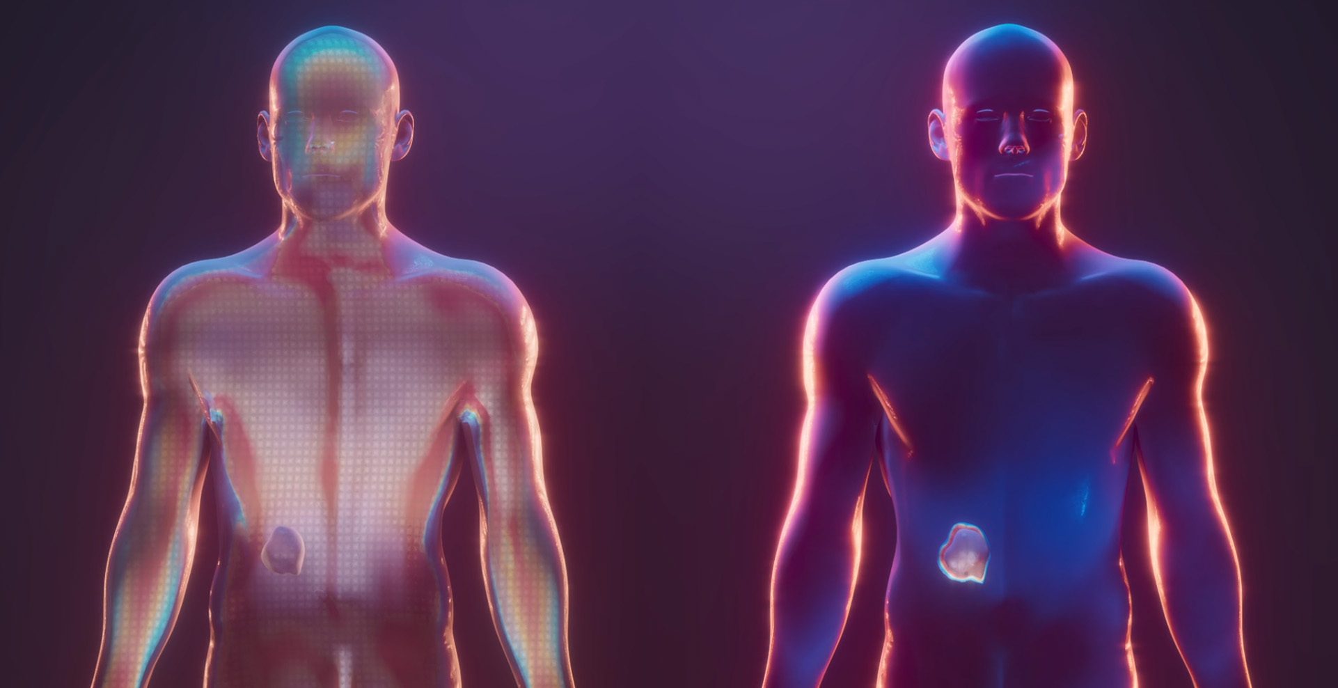 This 3D animation shows two models with a tumor in the belly 