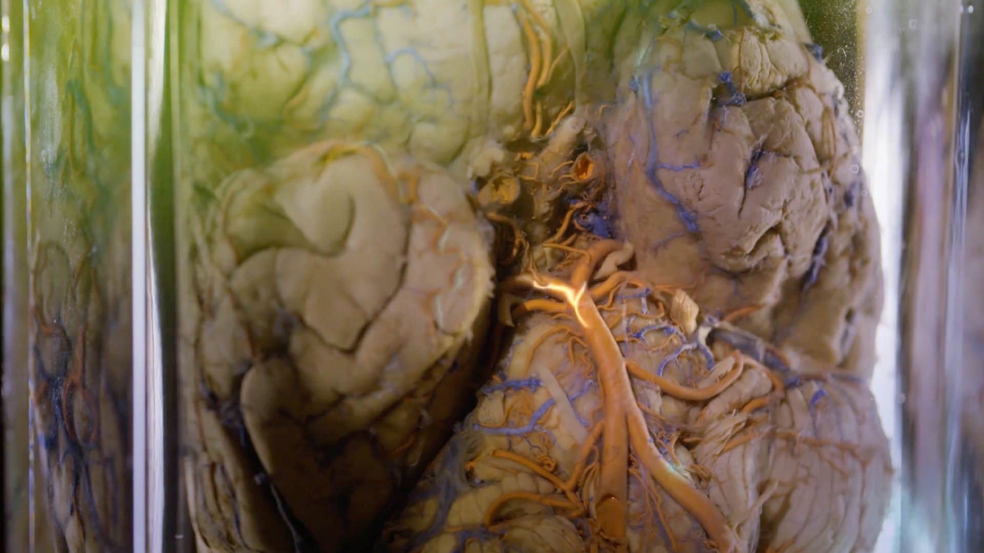 This image shows cardiovascular field part of Detlev Ganten portrait film