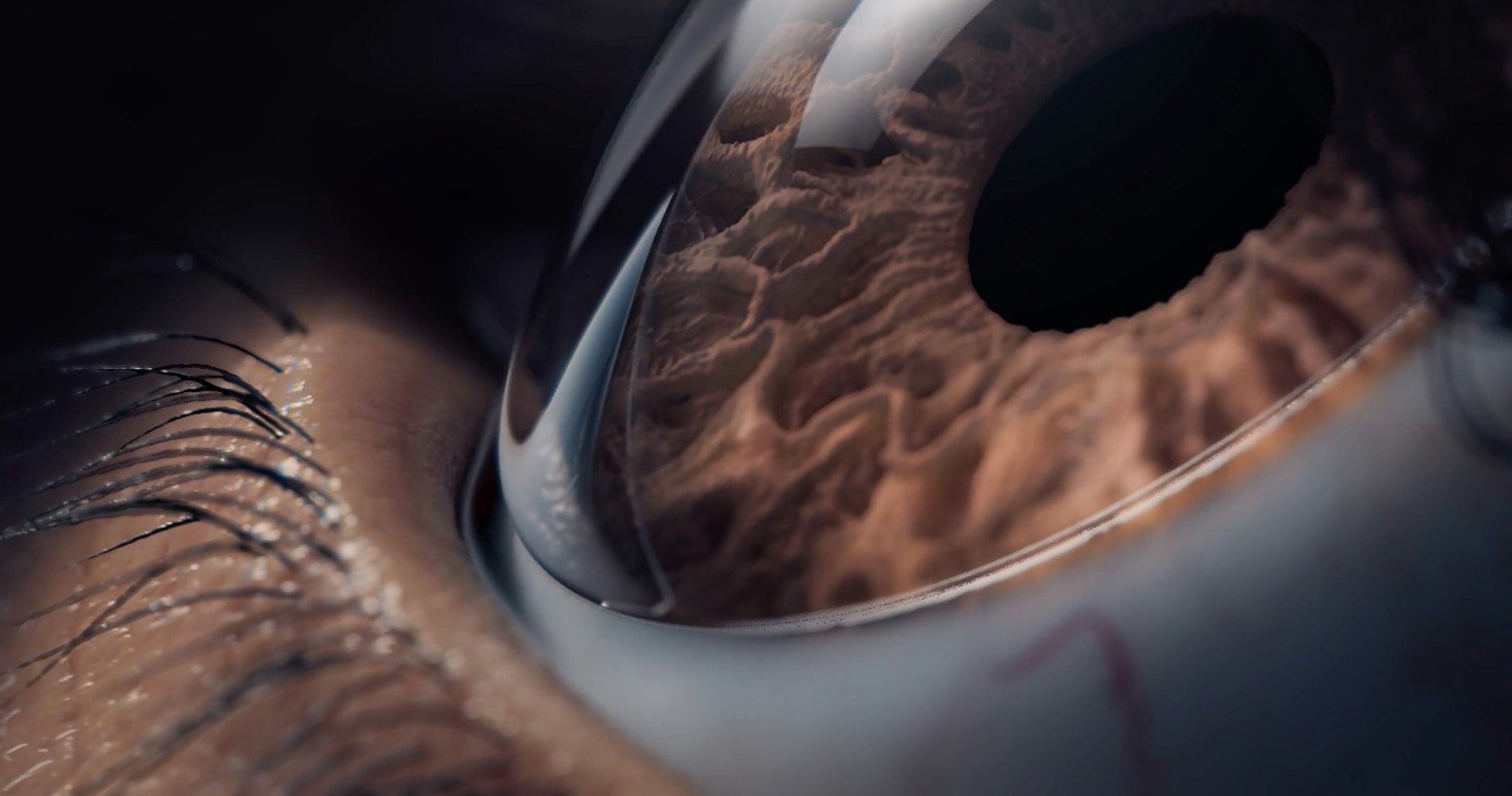 Extreme close-up view of a 3D-animated eye wearing Lynthera's contact lens for ocular drug delivery